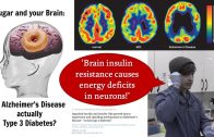 3 tips to optimize BRAIN HEALTH & prevent DEMENTIA | Alzheimer’s Disease is Type 3 Diabetes!